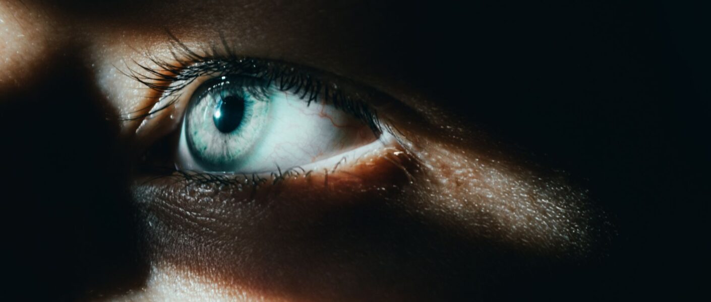 Blepharoplasty